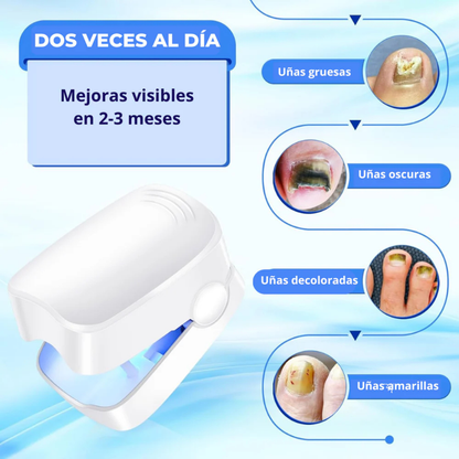 Láser LED para Uñas con Hongos