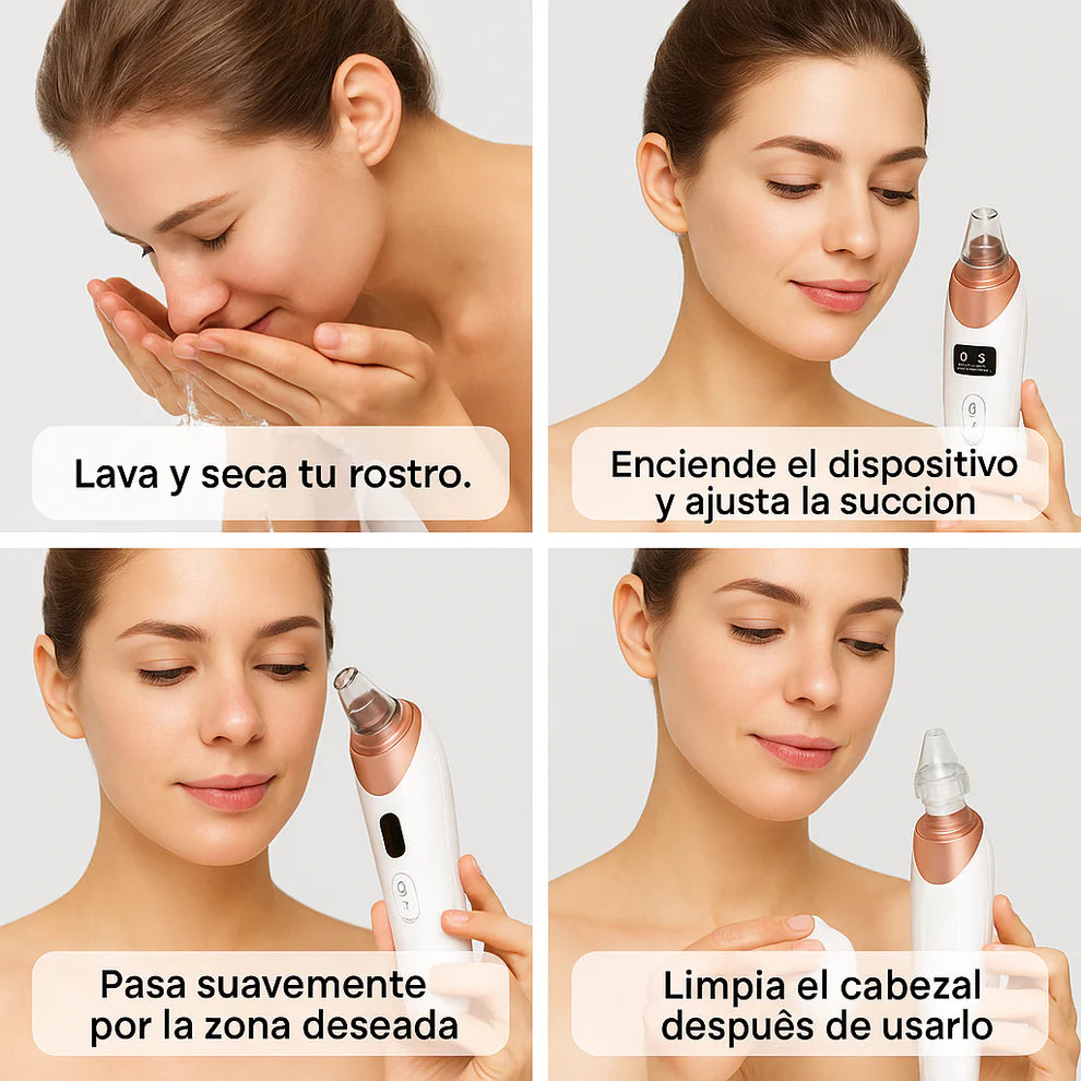 Extractor de Espinillas sin Dolor + Obsequio